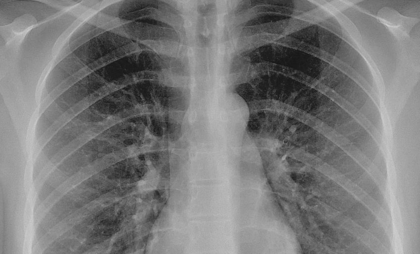 Vil jeg dykke med dette da?